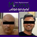 ترمیم مو موتاب